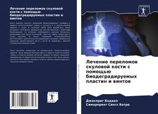 Couverture de Лечение переломов скуловой кости с помощью биодеградируемых пластин и винтов