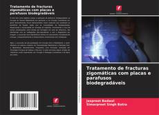 Buchcover von Tratamento de fracturas zigomáticas com placas e parafusos biodegradáveis