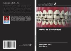 Copertina di Arcos de ortodoncia