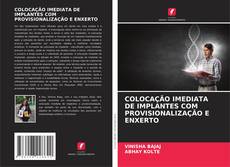 Buchcover von COLOCAÇÃO IMEDIATA DE IMPLANTES COM PROVISIONALIZAÇÃO E ENXERTO