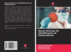 Buchcover von Novas técnicas de identificação de hemoculturas