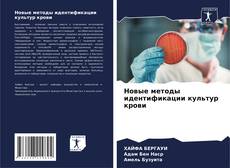 Bookcover of Новые методы идентификации культур крови