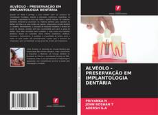 Buchcover von ALVÉOLO - PRESERVAÇÃO EM IMPLANTOLOGIA DENTÁRIA