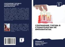 Couverture de СОХРАНЕНИЕ ГНЕЗДА В СТОМАТОЛОГИИ НА ИМПЛАНТАТАХ