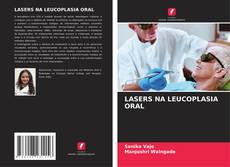 Buchcover von LASERS NA LEUCOPLASIA ORAL