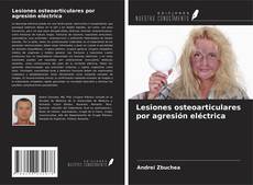 Copertina di Lesiones osteoarticulares por agresión eléctrica