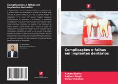 Buchcover von Complicações e falhas em implantes dentários