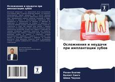 Bookcover of Осложнения и неудачи при имплантации зубов