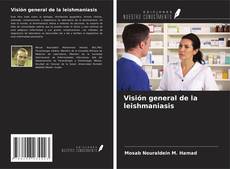 Buchcover von Visión general de la leishmaniasis