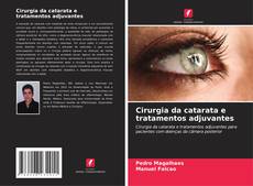 Buchcover von Cirurgia da catarata e tratamentos adjuvantes