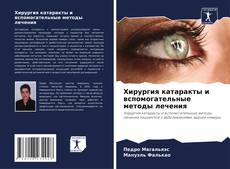 Couverture de Хирургия катаракты и вспомогательные методы лечения