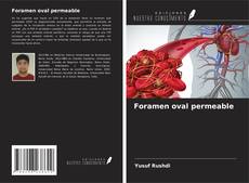 Bookcover of Foramen oval permeable