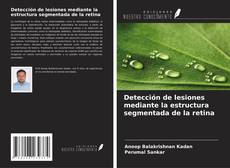 Copertina di Detección de lesiones mediante la estructura segmentada de la retina