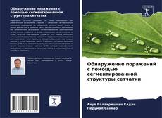 Couverture de Обнаружение поражений с помощью сегментированной структуры сетчатки