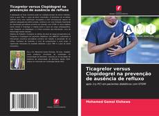 Buchcover von Ticagrelor versus Clopidogrel na prevenção de ausência de refluxo