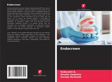 Buchcover von Endocrown