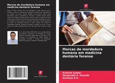 Buchcover von Marcas de mordedura humana em medicina dentária forense