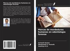 Buchcover von Marcas de mordeduras humanas en odontología forense
