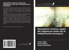 Copertina di Hemoptisis masiva: papel del angioscan antes de la embolización bronquial