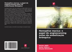 Buchcover von Hemoptise maciça: o papel do angioscanning antes da embolização brônquica