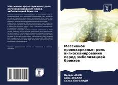 Couverture de Массивное кровохарканье: роль ангиосканирования перед эмболизацией бронхов