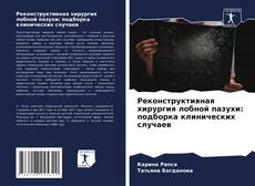 Couverture de Реконструктивная хирургия лобной пазухи: подборка клинических случаев