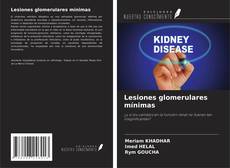 Copertina di Lesiones glomerulares mínimas