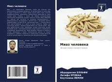 Couverture de Миаз человека