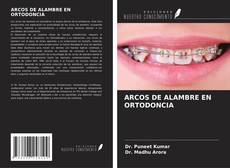 Copertina di ARCOS DE ALAMBRE EN ORTODONCIA