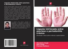 Buchcover von Ligação intrincada entre psoríase e periodontite crónica