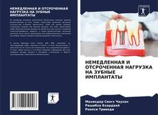 Couverture de НЕМЕДЛЕННАЯ И ОТСРОЧЕННАЯ НАГРУЗКА НА ЗУБНЫЕ ИМПЛАНТАТЫ