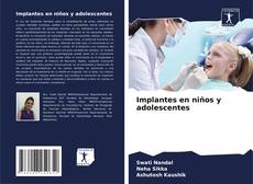 Couverture de Implantes en niños y adolescentes