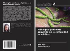 Buchcover von Meningitis purulenta adquirida en la comunidad en adultos