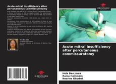Portada del libro de Acute mitral insufficiency after percutaneous commissurotomy