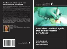 Capa do livro de Insuficiencia mitral aguda tras comisurotomía percutánea 