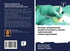 Bookcover of Острая митральная недостаточность после чрескожной комиссуротомии