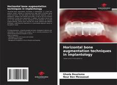 Couverture de Horizontal bone augmentation techniques in implantology