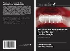 Capa do livro de Técnicas de aumento óseo horizontal en implantología 