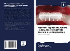 Couverture de Методы горизонтального наращивания костной ткани в имплантологии