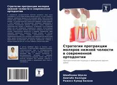 Bookcover of Стратегии протракции моляров нижней челюсти в современной ортодонтии