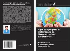 Buchcover von Agar sangre para el aislamiento de Mycobacterium tuberculosis