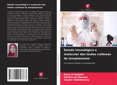 Copertina di Estudo imunológico e molecular das lesões cutâneas da toxoplasmose