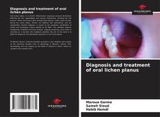 Bookcover of Diagnosis and treatment of oral lichen planus