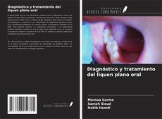 Обложка Diagnóstico y tratamiento del liquen plano oral