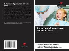 Bookcover of Retention of permanent anterior teeth