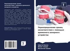 Couverture de Переопределение границ несоответствия с помощью временного анкерного устройства