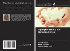 Bookcover of Hiperglucemia y sus complicaciones