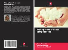 Buchcover von Hiperglicemia e suas complicações