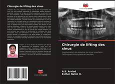 Bookcover of Chirurgie de lifting des sinus