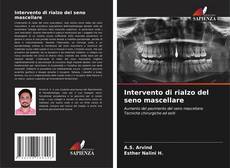 Bookcover of Intervento di rialzo del seno mascellare